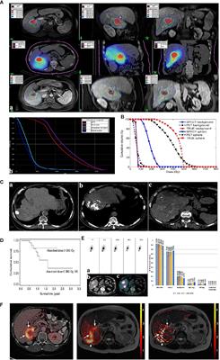 Diagnostic Performance of Theranostic Radionuclides Used in Transarterial Radioembolization for Liver Cancer